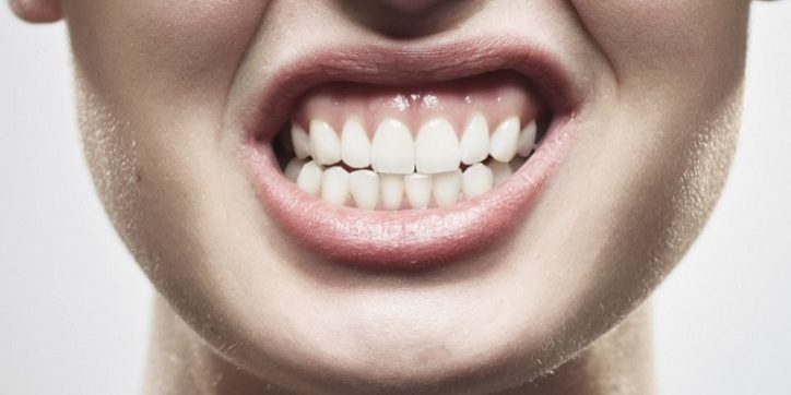 bruxismo-valladolid Osteopatia Valladolid