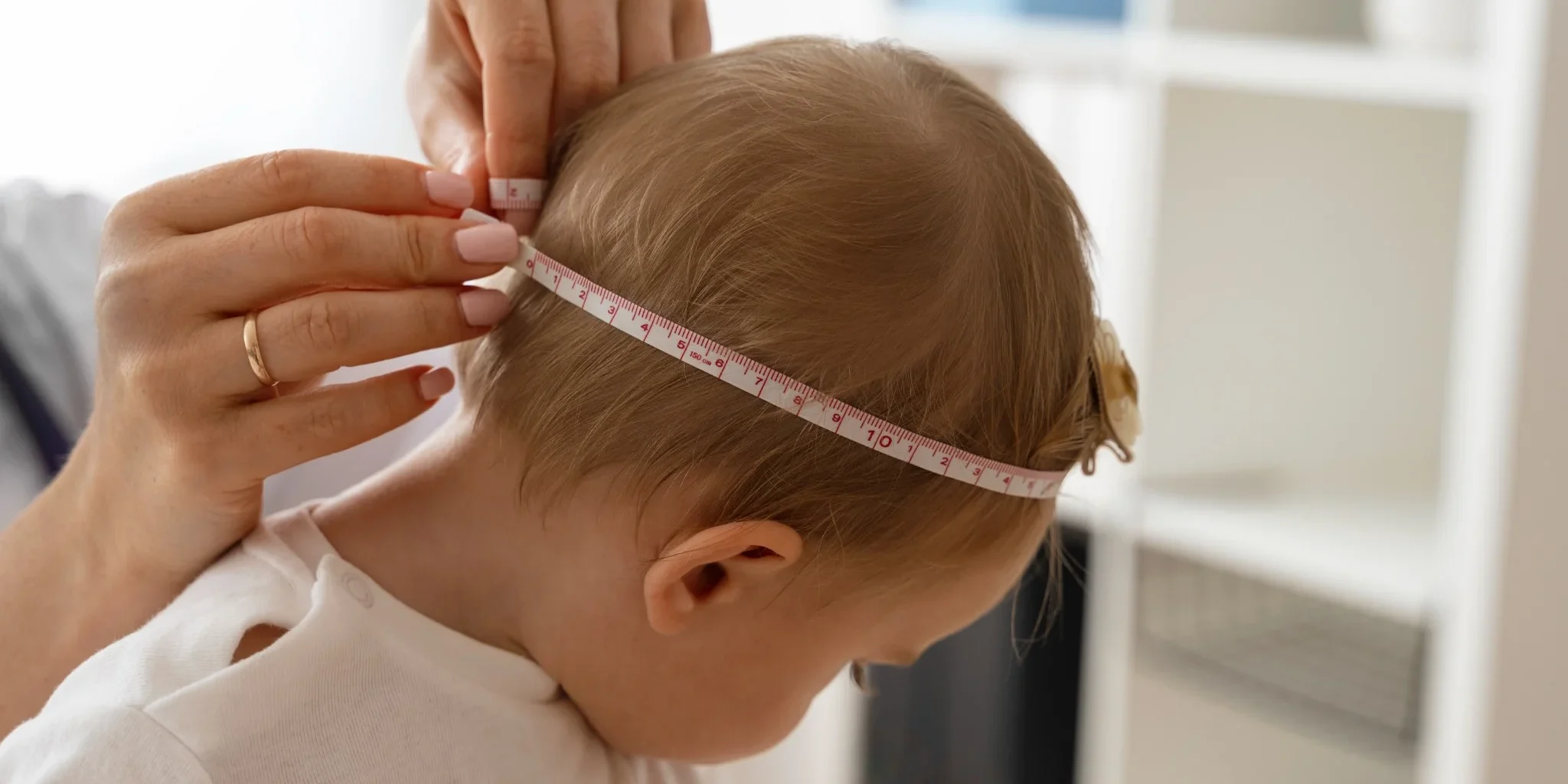 plagiocefalia en valladolid